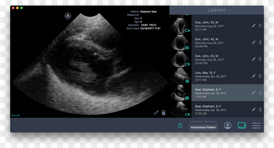 Screenshot, Ct Scan, Adult, Male, Man Png Image