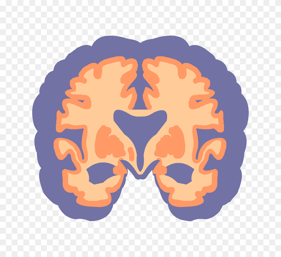 Search Results, Ct Scan, Baby, Person, Head Png