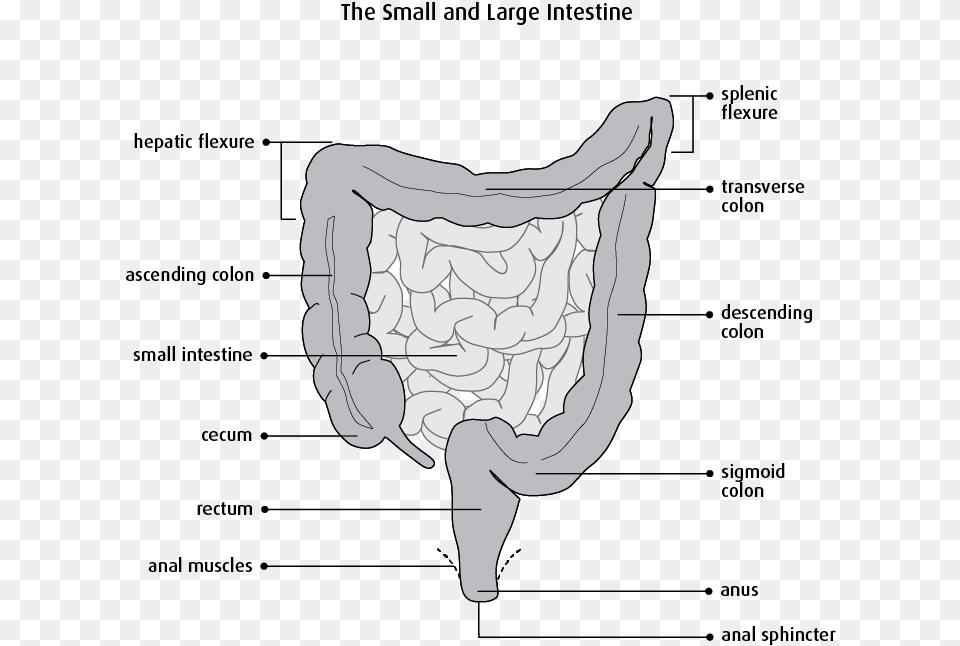 Segmental Resection Of Small Bowel Small Bowel Segmental Resection, Baby, Person Free Png