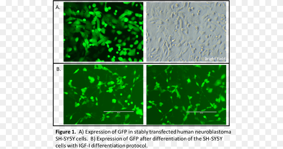 Sh Sy5y Cells Showing Gfp Expression Sh, Light, Accessories, Gemstone, Jewelry Png Image