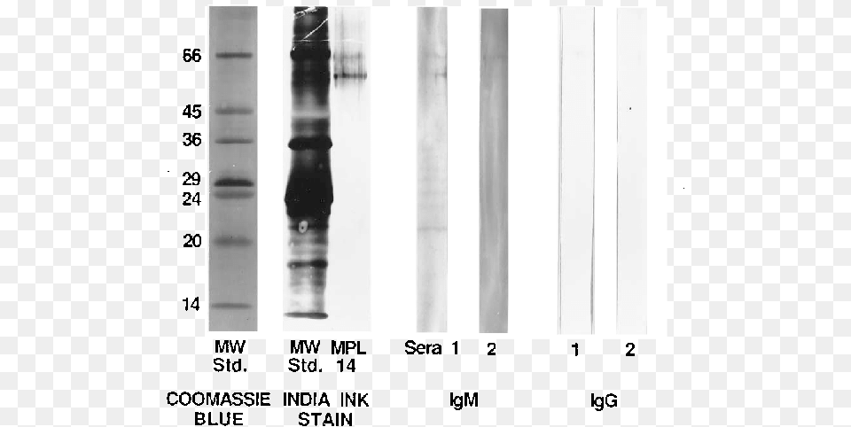 Showing The Different Patterns Of Staining Of The Molecular Monochrome, Mortar Shell, Weapon Free Png