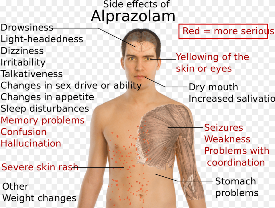 Side Effects Of Alprazolam Que Hace El Alprazolam, Adult, Plot, Person, Neck Free Transparent Png
