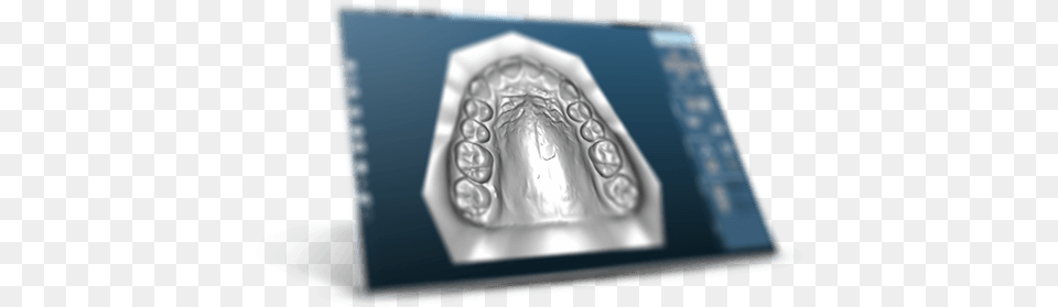 Silver, Ct Scan Free Transparent Png