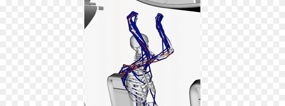 Simulation Of Bin Closing, Ct Scan, Baby, Person, Head Png Image