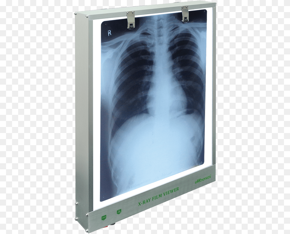 Single Sided Led X Ray Viewer Style Max Height X Ray Film Viewer, Computer Hardware, Electronics, Hardware, Monitor Free Png Download