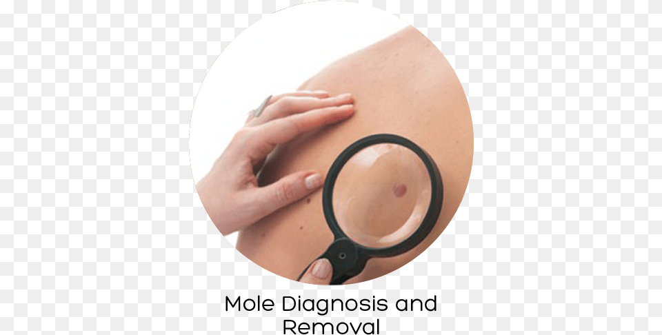 Skin Cancer, Body Part, Finger, Hand, Person Png