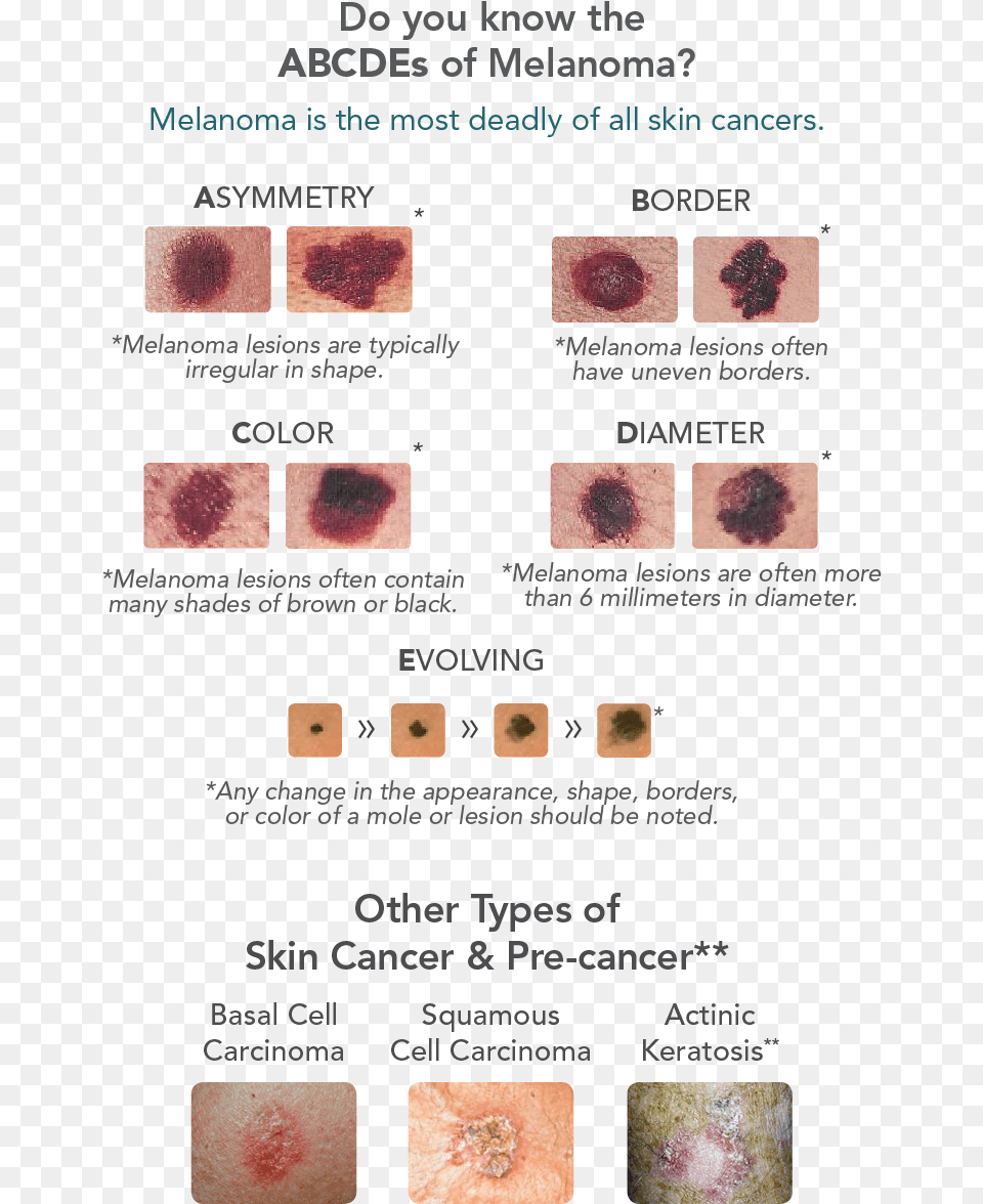 Skin Cancer Warning Signs, Face, Head, Person Png Image