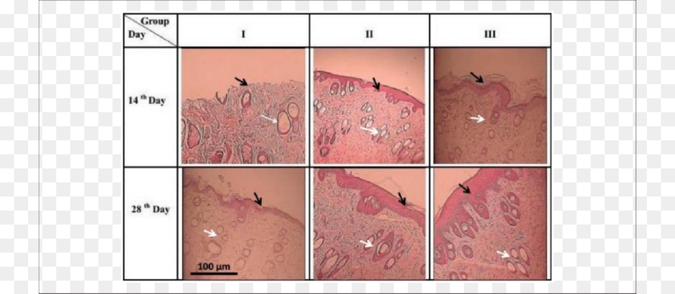 Skin Photomicrographs Of Second Degree Burns Treated Aloe Vera, Animal, Bird Free Png Download