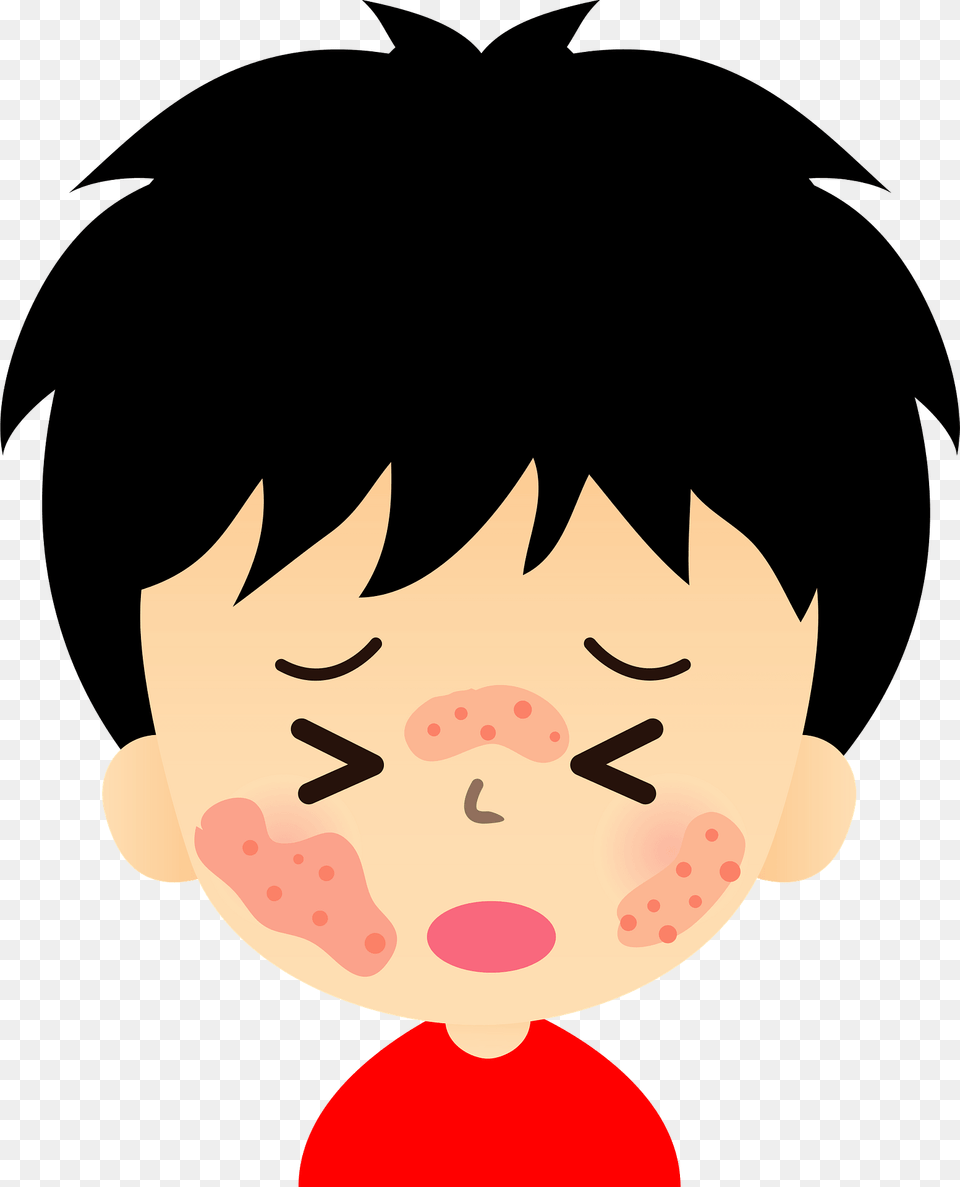 Skin Rash Dermatitis Eczema Or Hives Clipart, Baby, Person, Head, Face Free Transparent Png