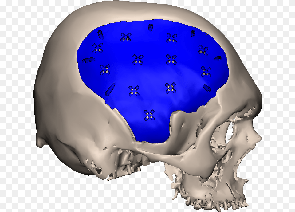 Skull, Ct Scan, Accessories, Gemstone, Jewelry Free Png Download