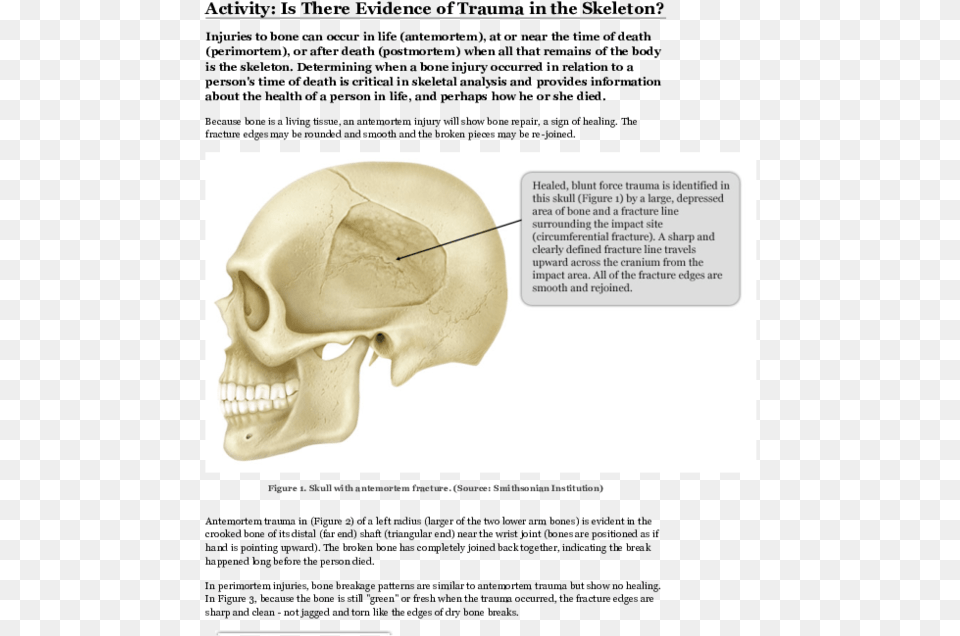 Skull, Head, Person, Face, Ct Scan Free Transparent Png