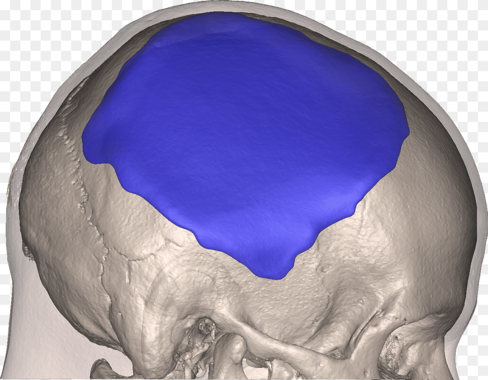 Skull, Ct Scan, Adult, Male, Man Free Png