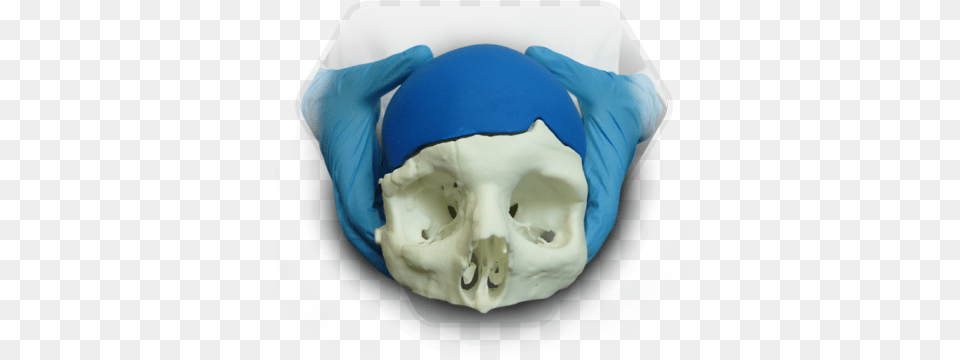 Skullpt Patient Specific Implant And Instrumentation Implant, Cap, Clothing, Hat, Adult Free Transparent Png