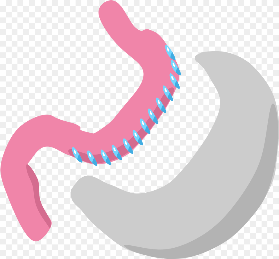 Sleeve Gastrectomy Wikipedia Bariatric Surgery, Body Part, Stomach, Smoke Pipe, Toothpaste Png Image