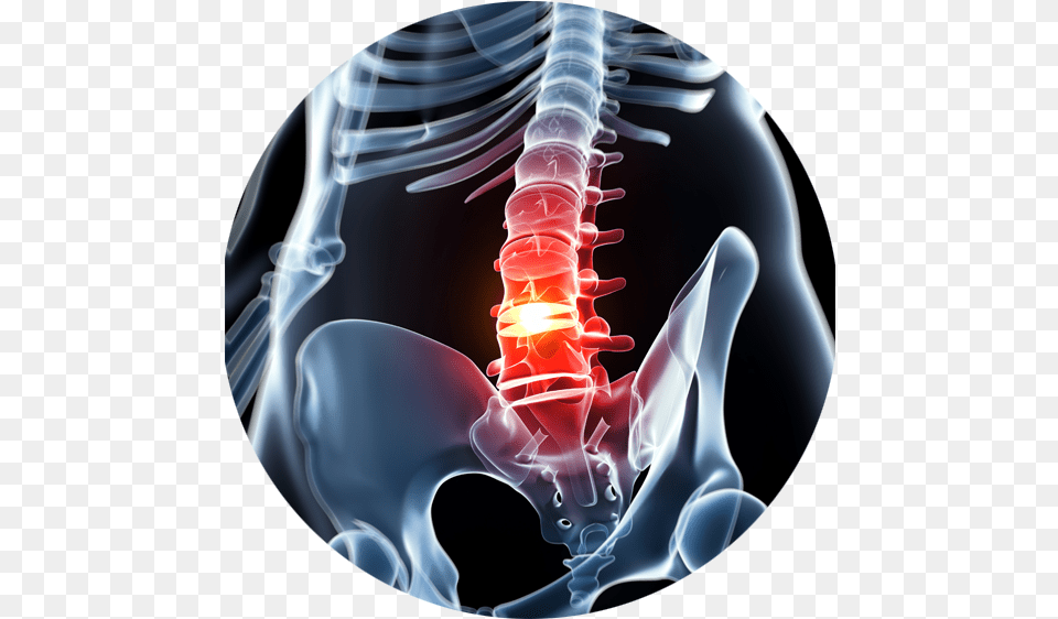 Slip Disc X Ray, Ct Scan Free Transparent Png