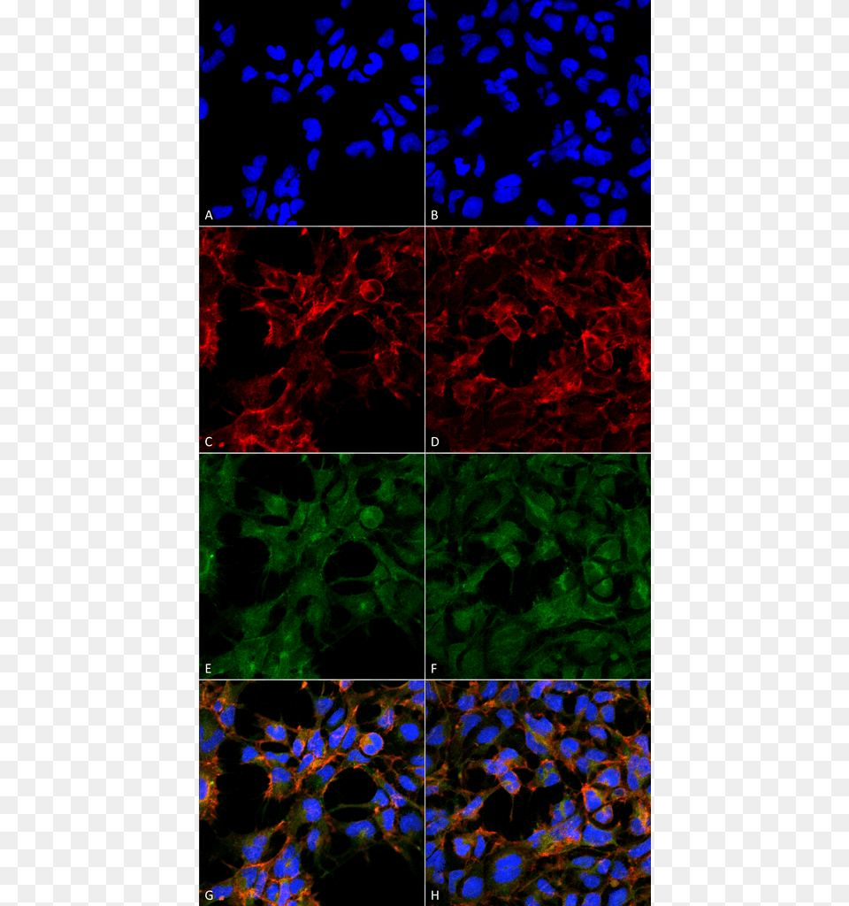 Smc 514 Malondialdehyde Antibody 6h6 Icc If Human Embryonic Malondialdehyde 1f83 Immunofluorescence, Accessories, Fractal, Ornament, Pattern Png Image