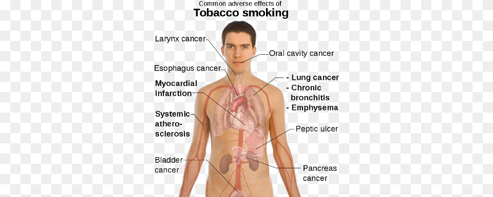 Smoking Effects On The Human Body Some Effects Of Smoking, Adult, Male, Man, Person Png Image