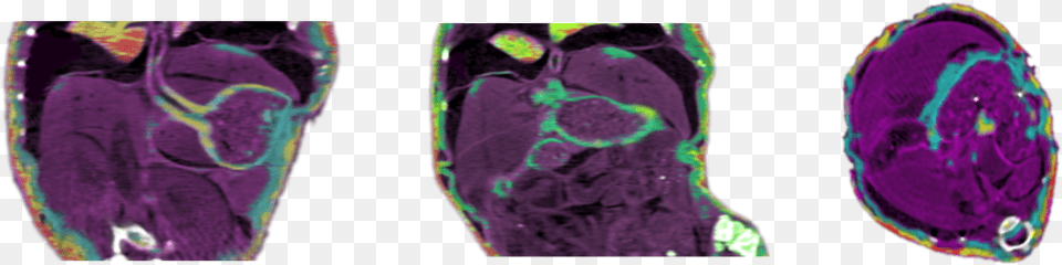 Spectral Computed Tomography Slices Where Each Colour Portable Network Graphics, Ct Scan, Purple, Accessories, Jewelry Png Image