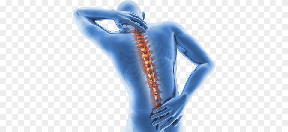 Spine Pain Ankylosing Spondylitis Diagnosis And Management, Adult, Female, Person, Woman Png Image