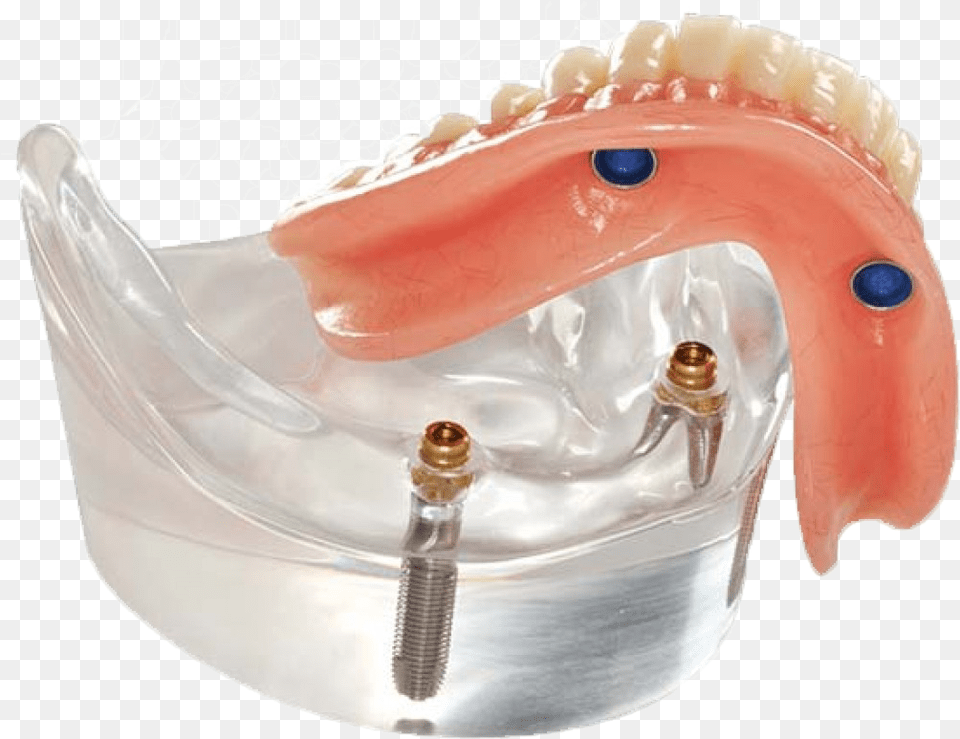 Stabilize Your Dentures And Regain Bite Strength, Body Part, Head, Mouth, Person Free Png