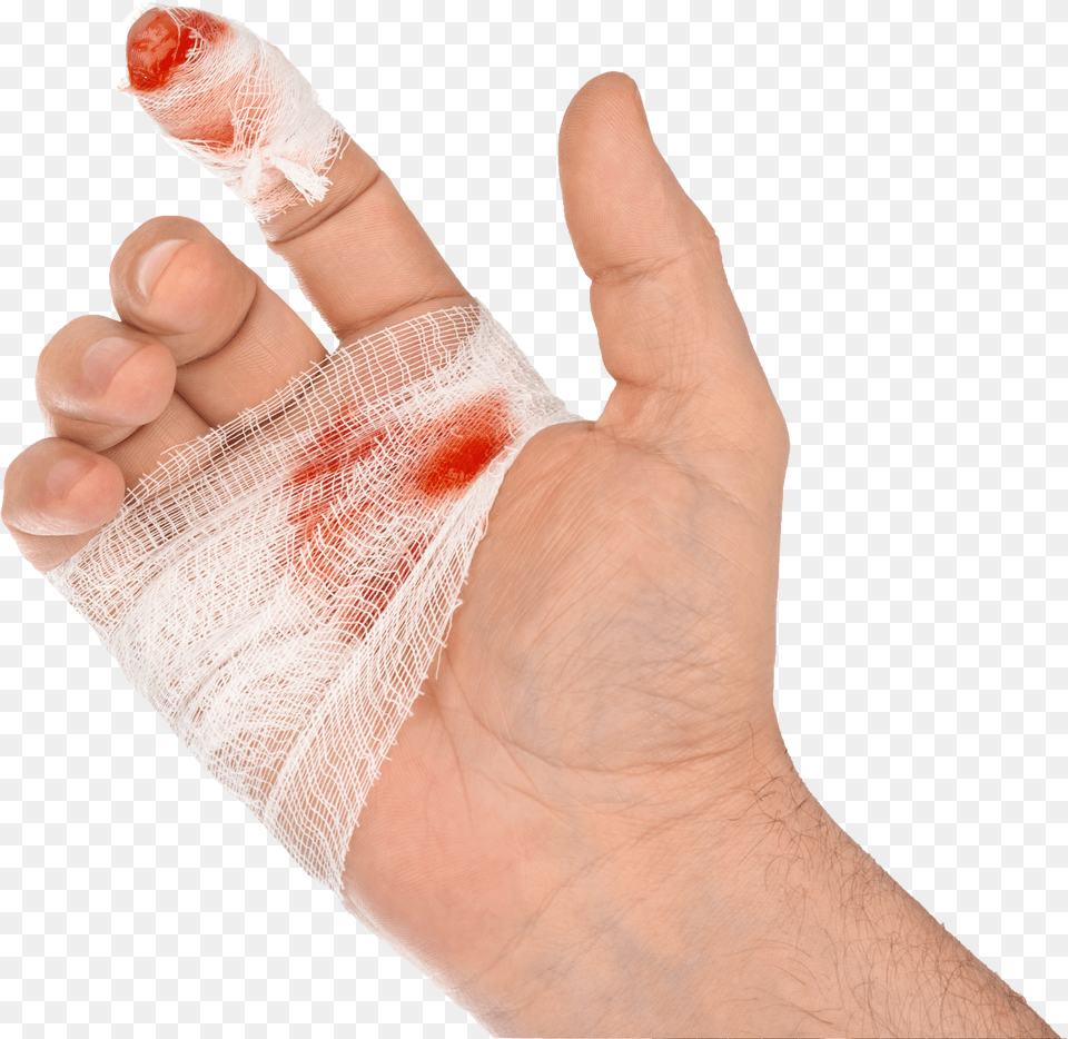 Steel Doctor Blade Injury Cut Hand Cut Download Free Png
