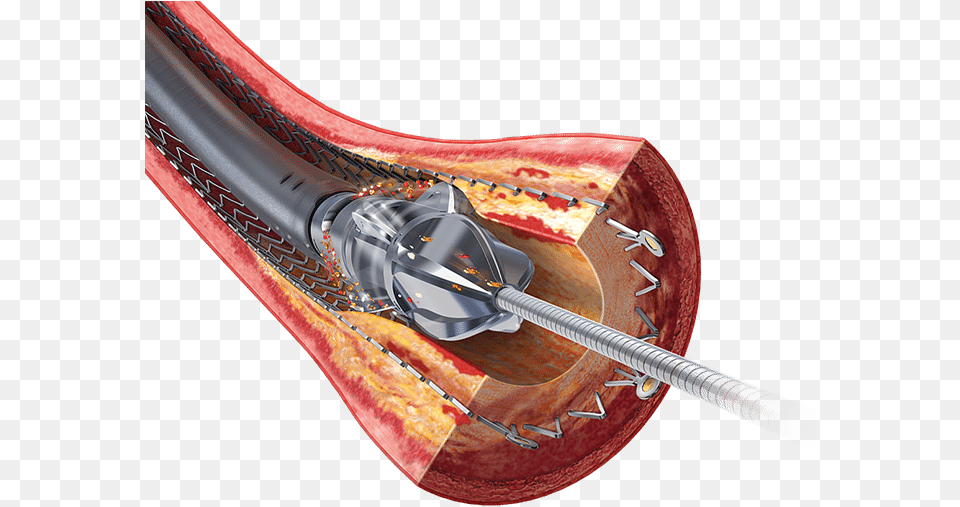 Stent Restenosis, Sword, Weapon Free Png Download