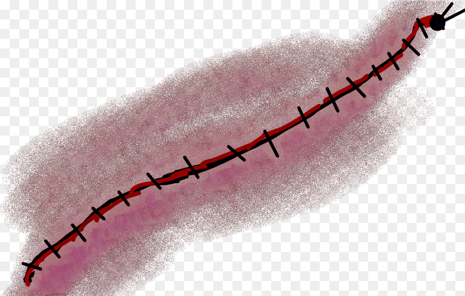Stitches, Body Part, Mouth, Person Png