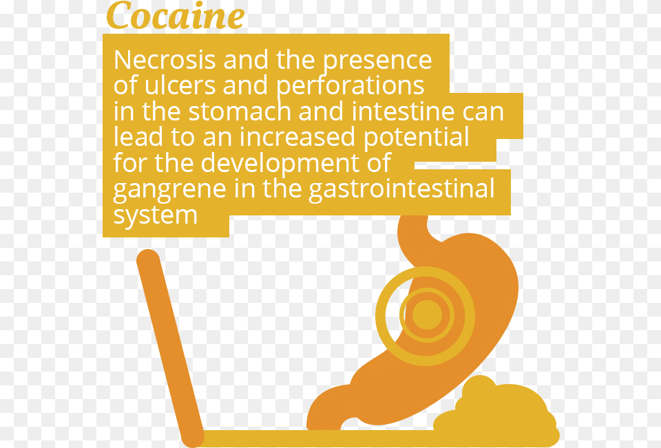 Stomach Cocaine Use And Stomach Issues Atlas Avanti Communications, Advertisement, Poster, Text Free Transparent Png