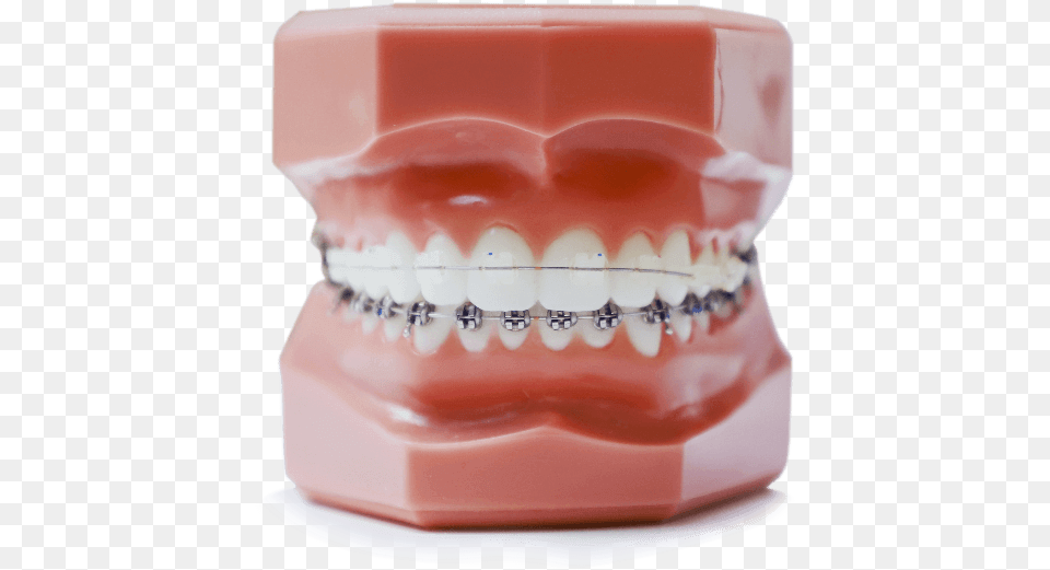 Straight Teeth Model, Body Part, Face, Head, Mouth Free Transparent Png