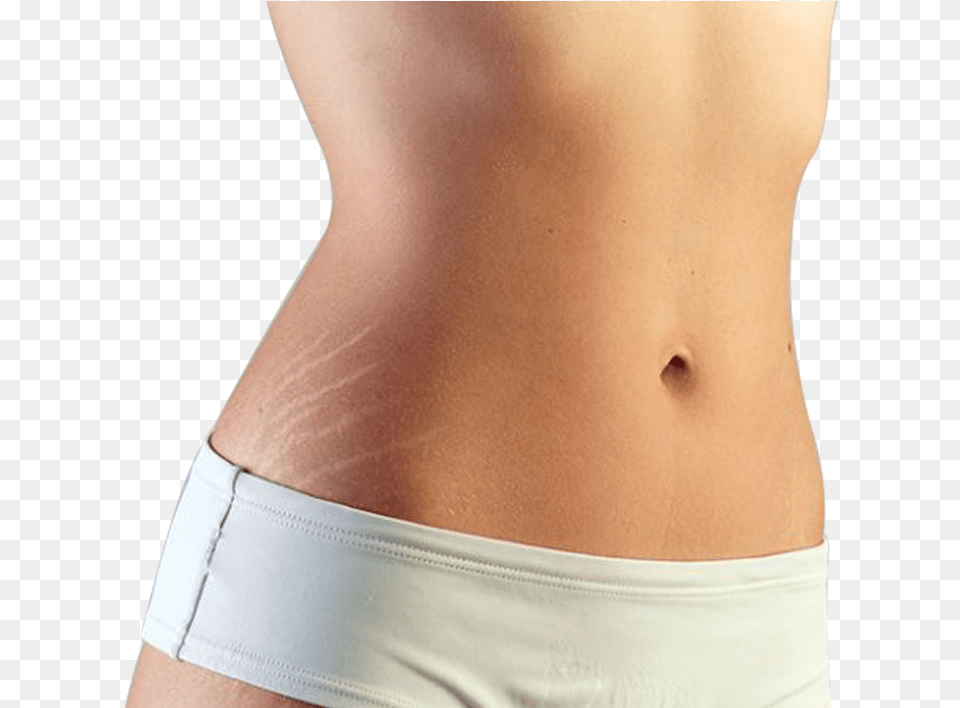 Stretch Marks, Back, Body Part, Person, Skin Png Image