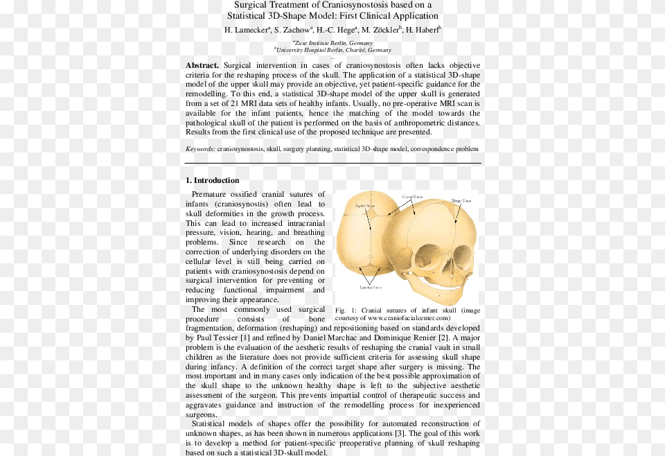 Surgical Treatment Of Craniosynostosis Based On A Statistical Skull, Ct Scan, Head, Person, Face Png