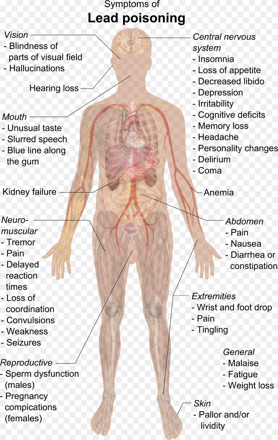 Symptoms Of Lead Poisoning Lead Poisoning Symptoms, Adult, Male, Man, Person Png