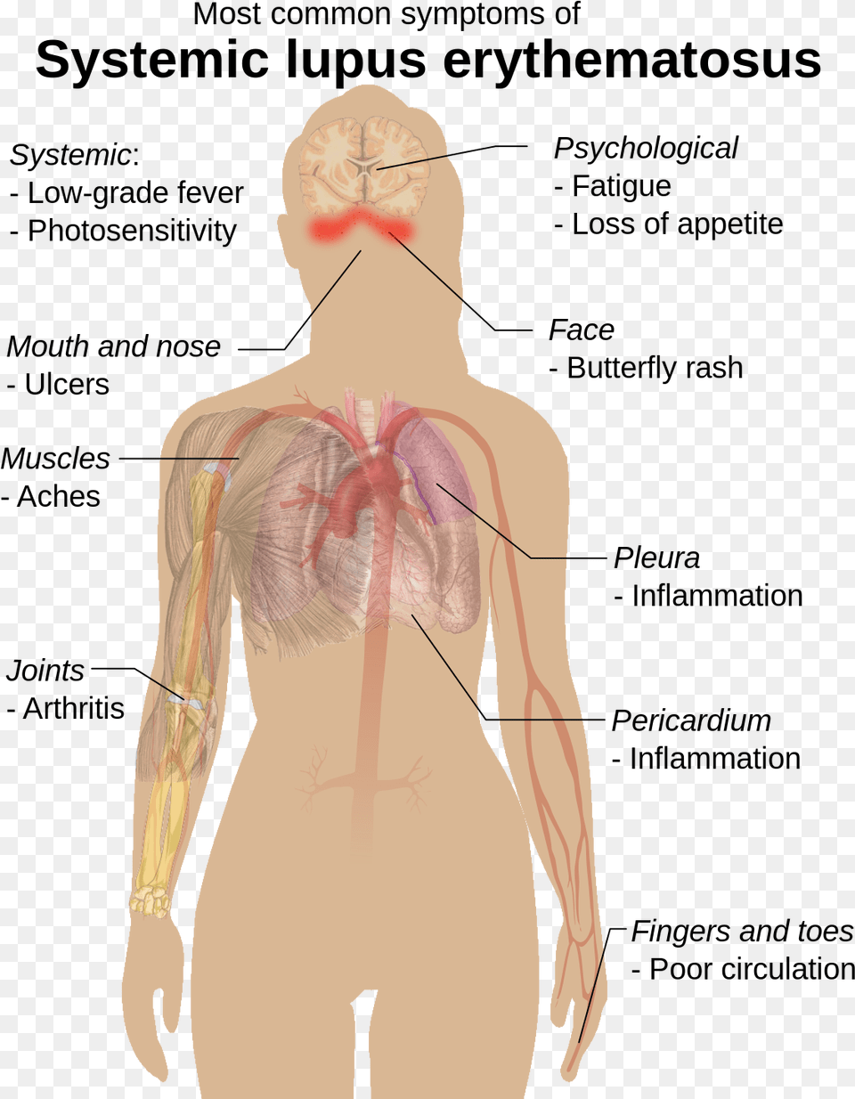 Symptoms Of Sle, Adult, Male, Man, Person Free Png Download
