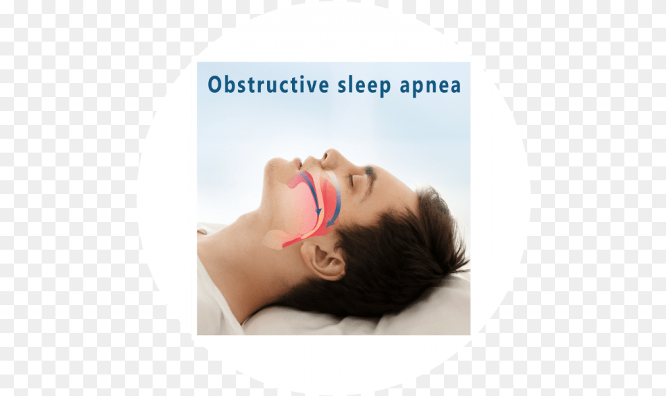 Symptoms Of Sleep Apnea Obstructive Sleep Apnea, Adult, Face, Head, Male Png Image
