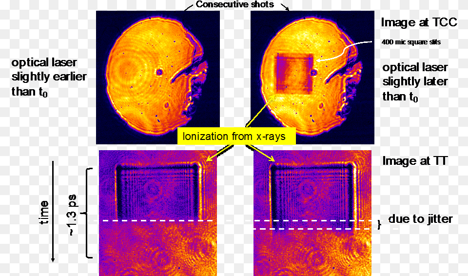 Synchronization Of Laser To The X Ray The Time Tool Art, Collage, Ct Scan, Accessories Png