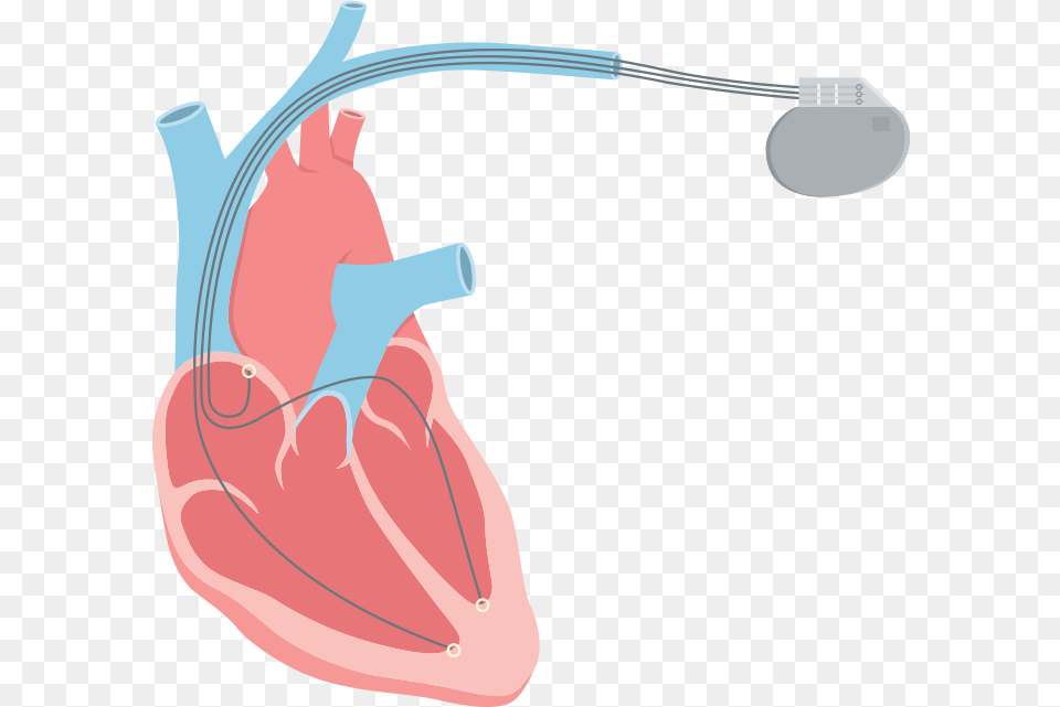 Systolic Heart Failure Also Called Heart Failure, Water Png Image