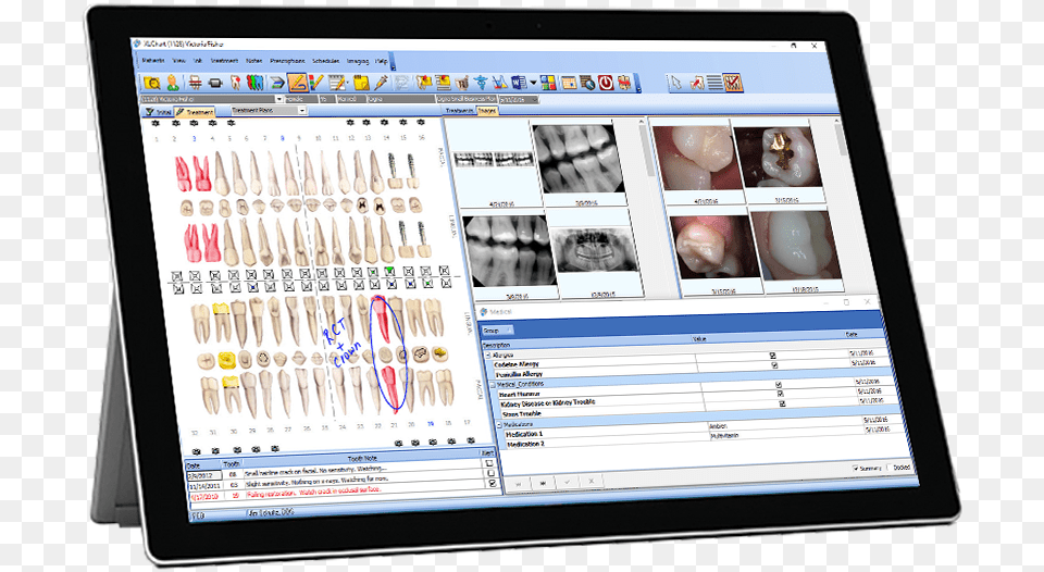 Tablet Mockup 12 19 16 Medical Practice Management Software, Computer, Electronics, Tablet Computer, Text Png