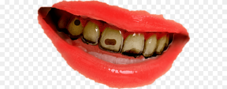 Teeth, Body Part, Mouth, Person Free Transparent Png