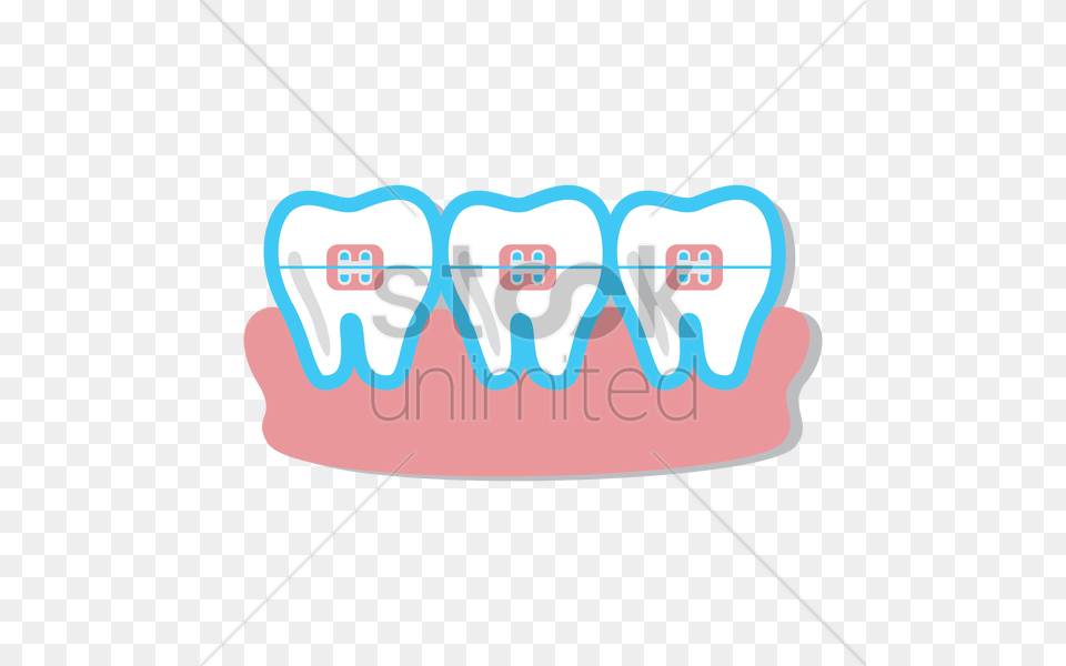 Teeth With Braces Vector Image, Body Part, Mouth, Person, Bow Free Png Download