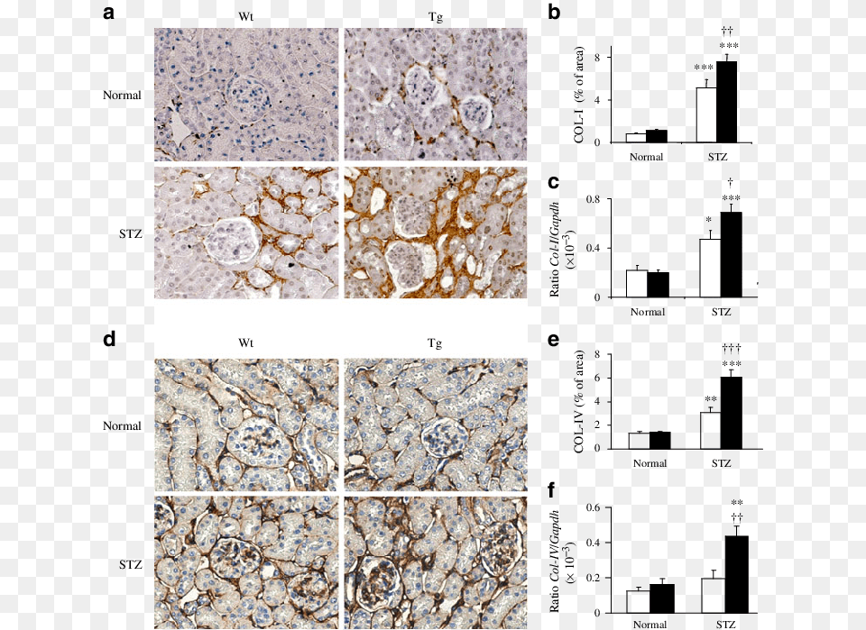 Tg Mice With Diabetes Collagen Type I Alpha Free Png