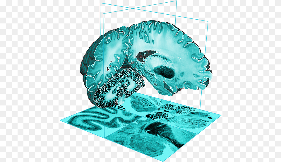 The Bigbrain Illustration, Ct Scan, Turquoise, Accessories, Gemstone Free Png