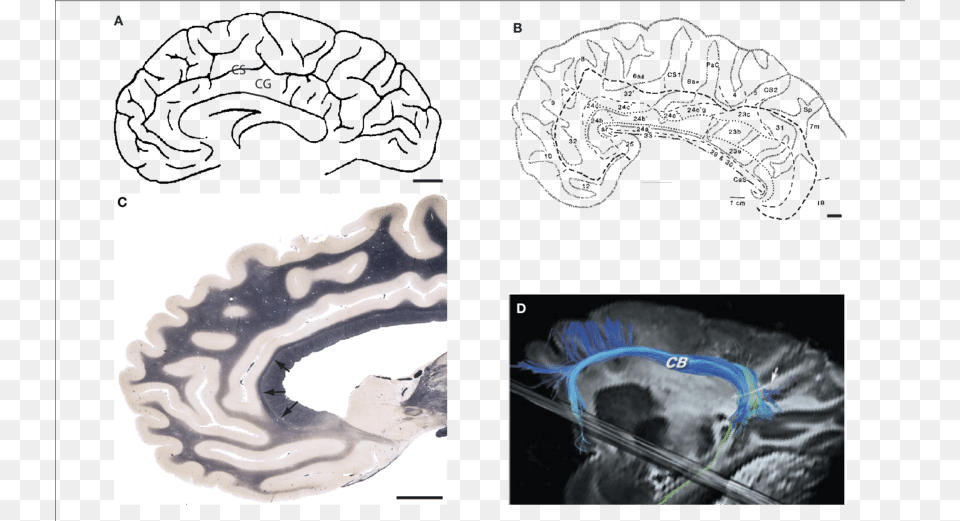 The Cingulate Cortex And Cingulum Bundle Cingulate Gyrus, Ct Scan Png Image
