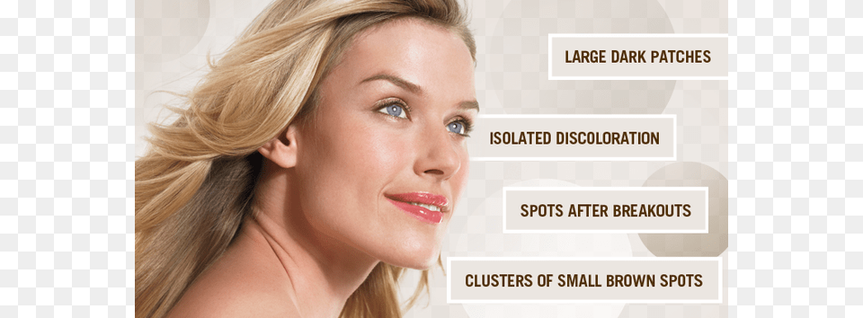 The Different Spots On Your Skin Remove Melasma On Face, Adult, Person, Woman, Head Free Png