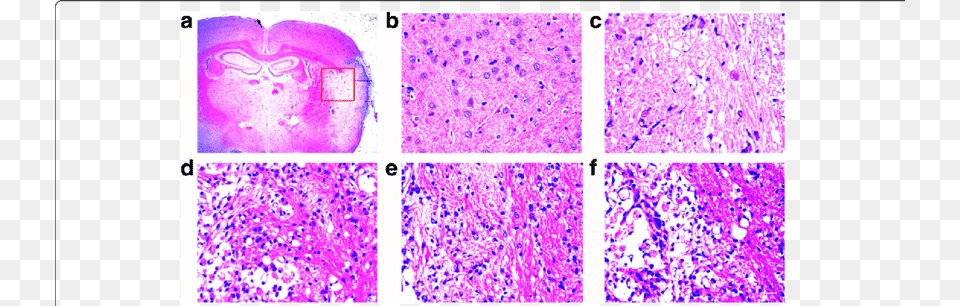 The Effect Of Sli Treatment On Neural Cell Injury In Common Fig, Purple, Paper, Baby, Person Png