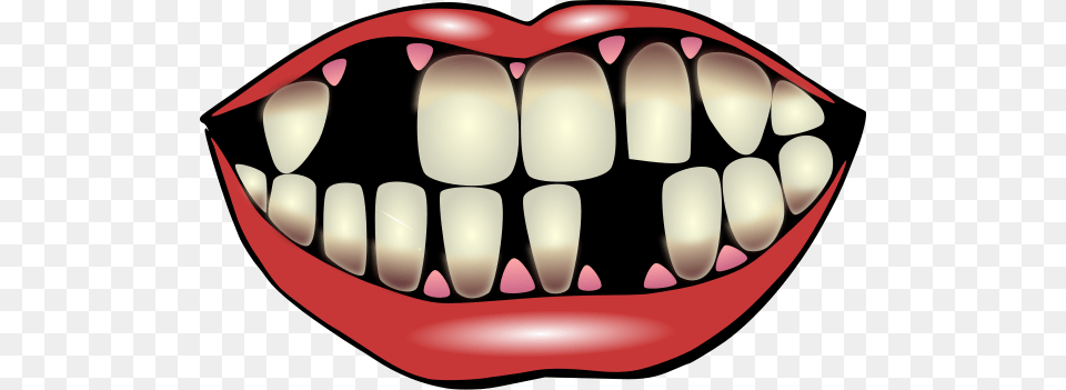 The Kiss Clip Arts For Web, Body Part, Mouth, Person, Teeth Free Png