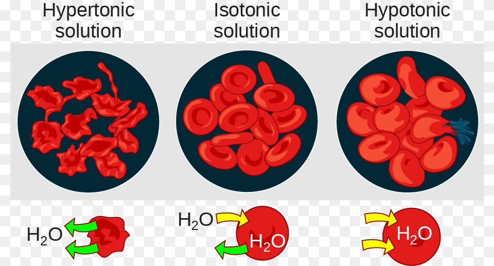 The Left Part Of This Illustration Shows Shriveled Hypertonic Or Hypotonic Png