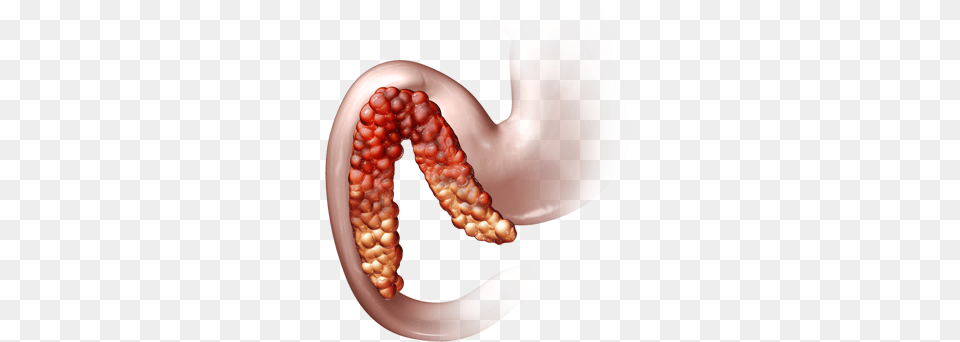 The Pancreas While Being A Small Organ Delivers A Annular Pancreas, Body Part, Stomach, Electronics, Hardware Png