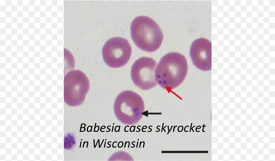 The Rising Prevalence Of Co Infections In Rodents May Babesia Peripheral Blood Smear, Balloon Png