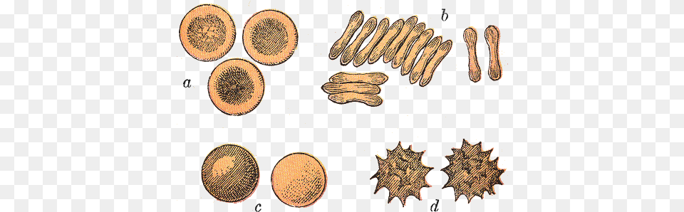 The Shapes Of Red Blood Cells In Different Contexts Sphrozytose Png