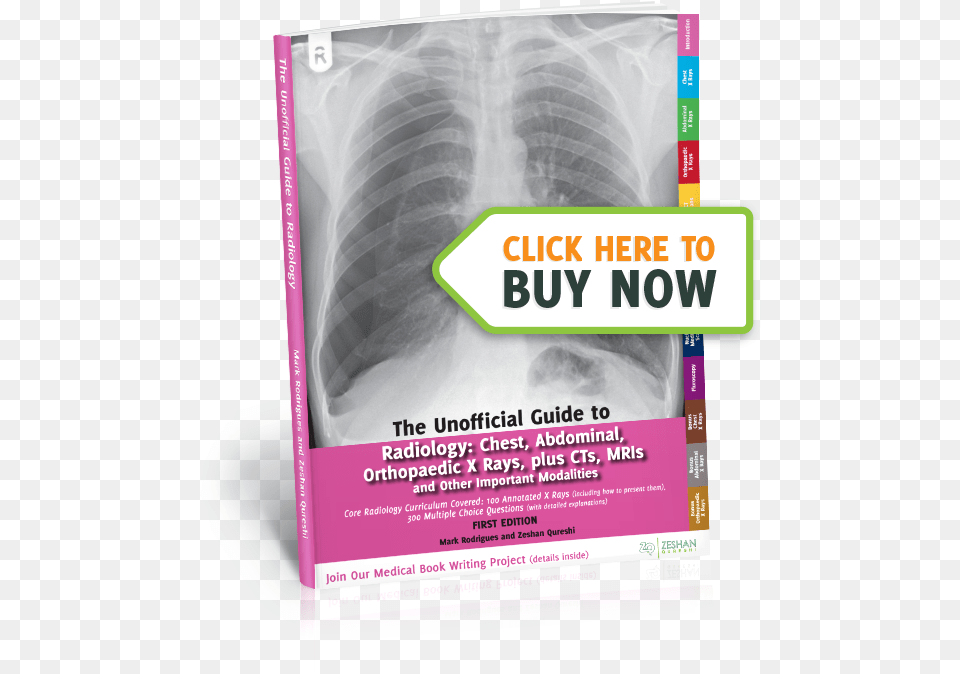 The Unoffical Guide To Radiology, Advertisement, Poster, X-ray Png Image